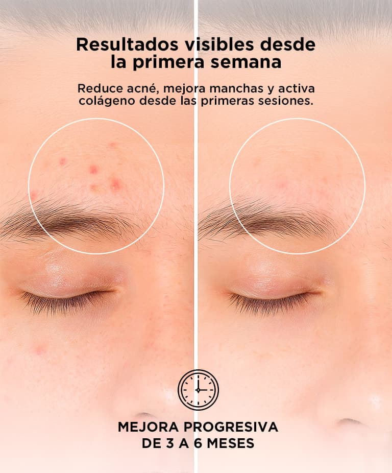 Imagen 6 del producto